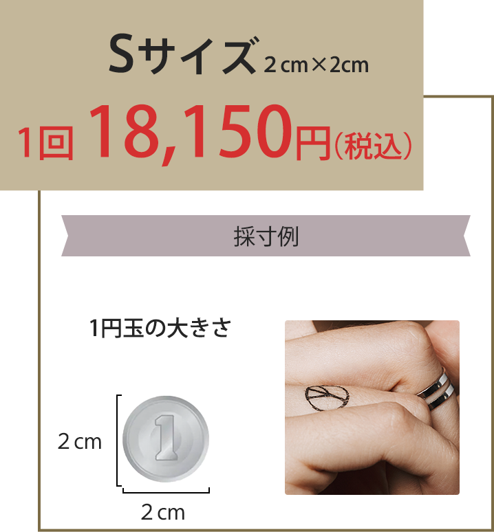 Sサイズ2cm×2cm1回18,150円(税込)