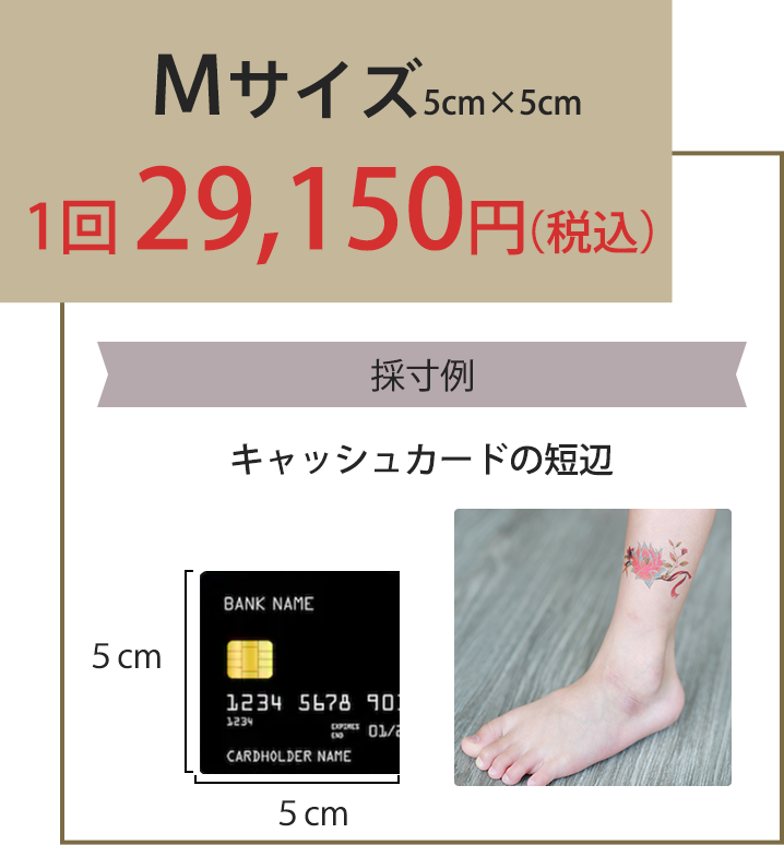 Mサイズ5cm×5cm1回29,150円(税込)