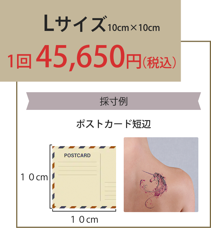 Lサイズ10cm×10cm1回45,650円(税込)
