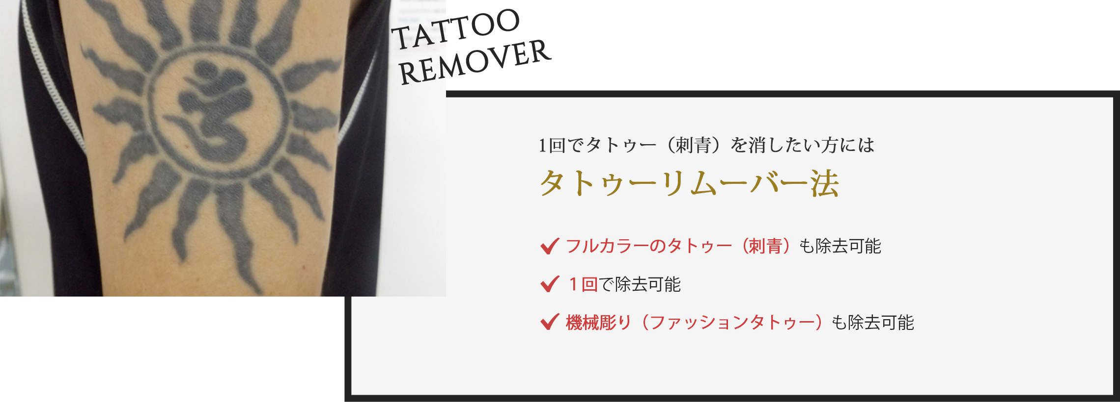 1回でタトゥー(刺青)を消したい方にはタトゥーリムーバー法