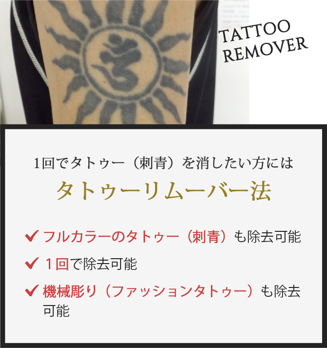 1回でタトゥー(刺青)を消したい方にはタトゥーリムーバー法