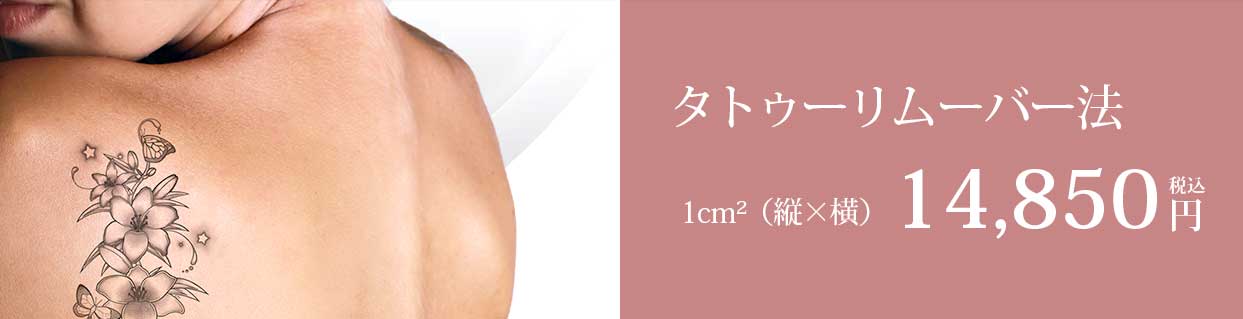 タトゥーリムーバー法14,850円