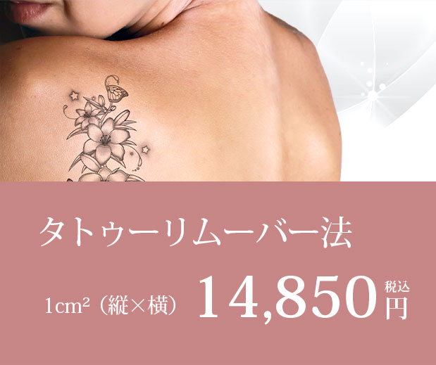 タトゥーリムーバー法14,850円